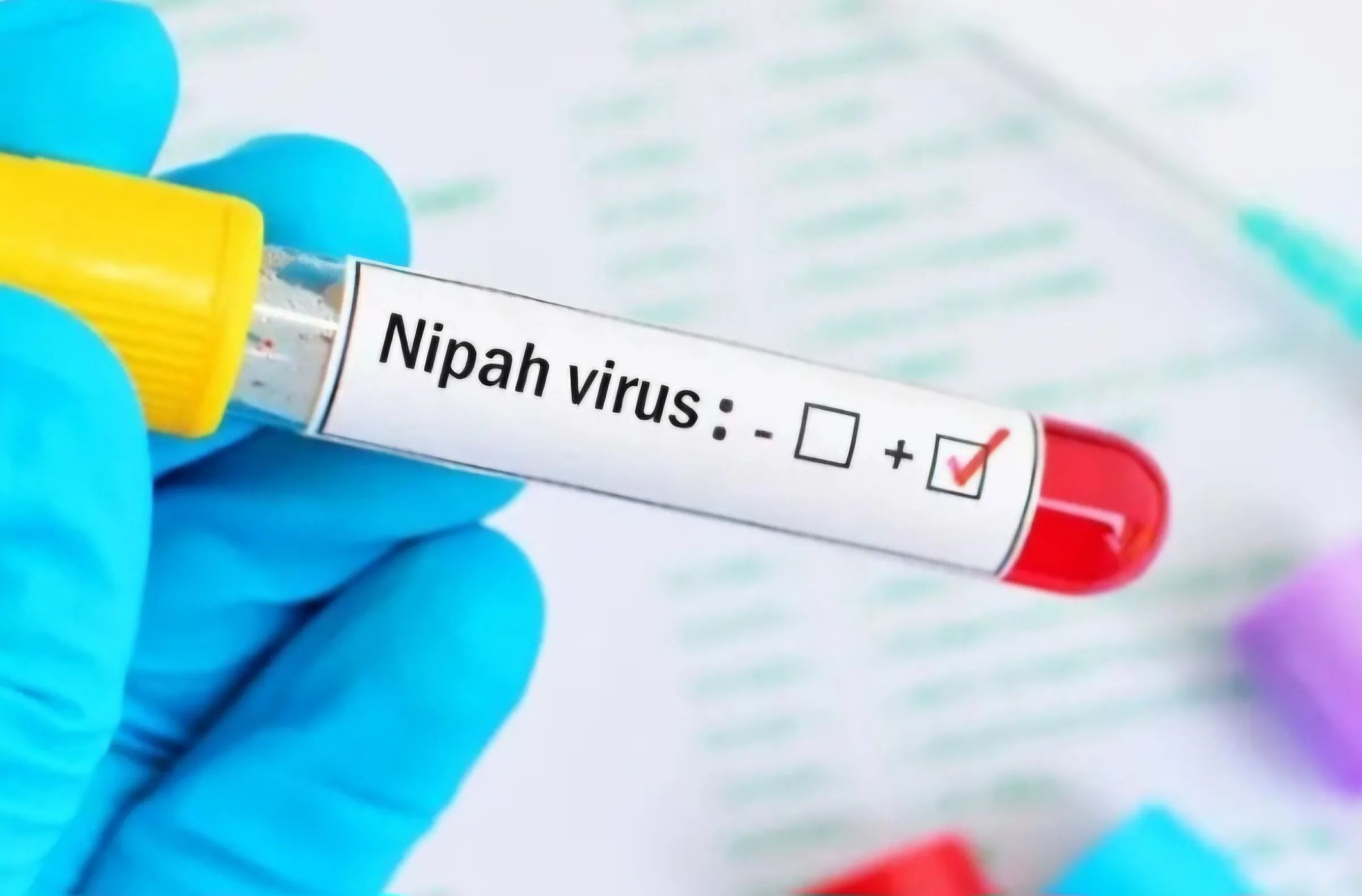 Nipah Virus jpg