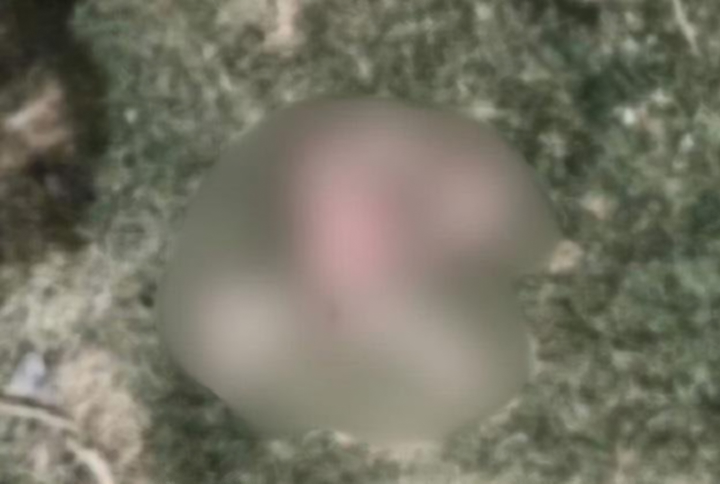 मानवता शर्मसार! नाले में फेंका गया नवजात का शव, आवारा कुत्ते बना रहे थे निवाला; दरभंगा अस्पताल की बड़ी लापरवाही