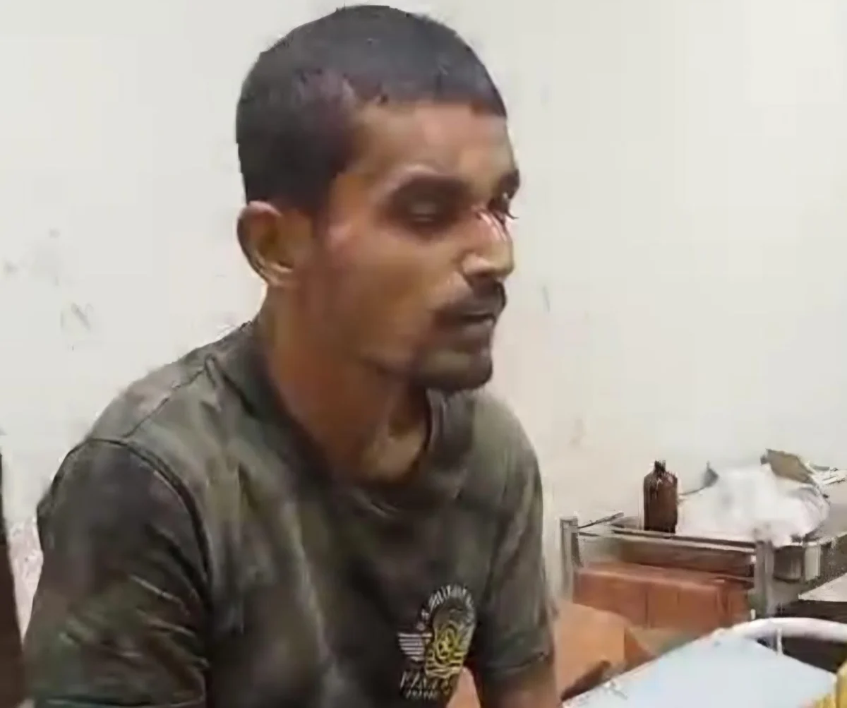 NH 31 पर 'हिट एंड रन' का शिकार हुआ अज्ञात युवक; भवानीपुर पुलिस ने बचाई जान, पहचान के लिए सोशल मीडिया का सहारा 1 NH 31 पर 'हिट एंड रन' का शिकार हुआ अज्ञात युवक; भवानीपुर पुलिस ने बचाई जान, पहचान के लिए सोशल मीडिया का सहारा