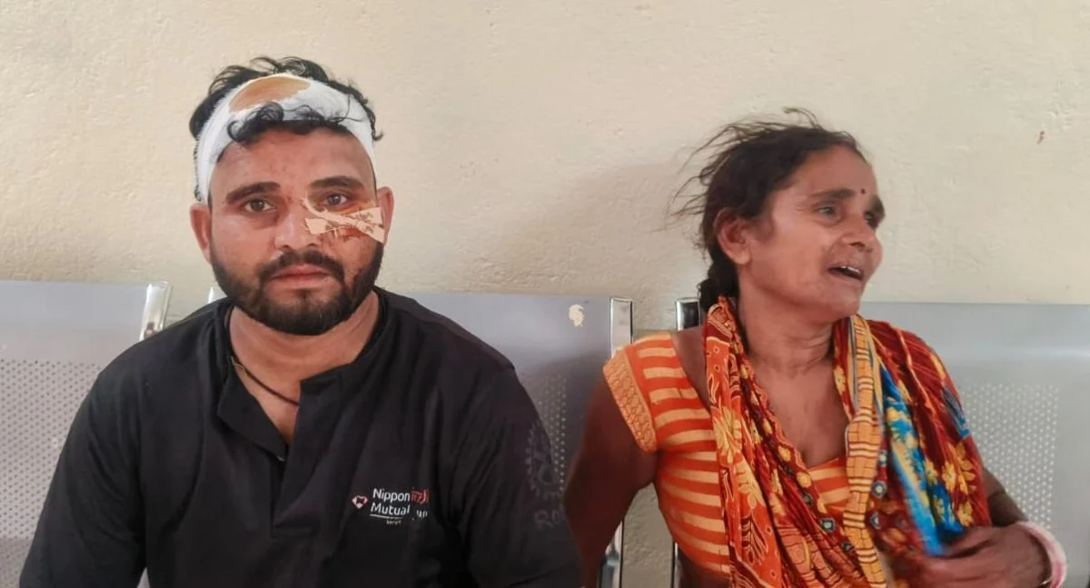 जमीन की नापी को लेकर बवाल, दो पक्षों में हिंसक झड़प, पिता-पुत्र गंभीर रूप से घायल