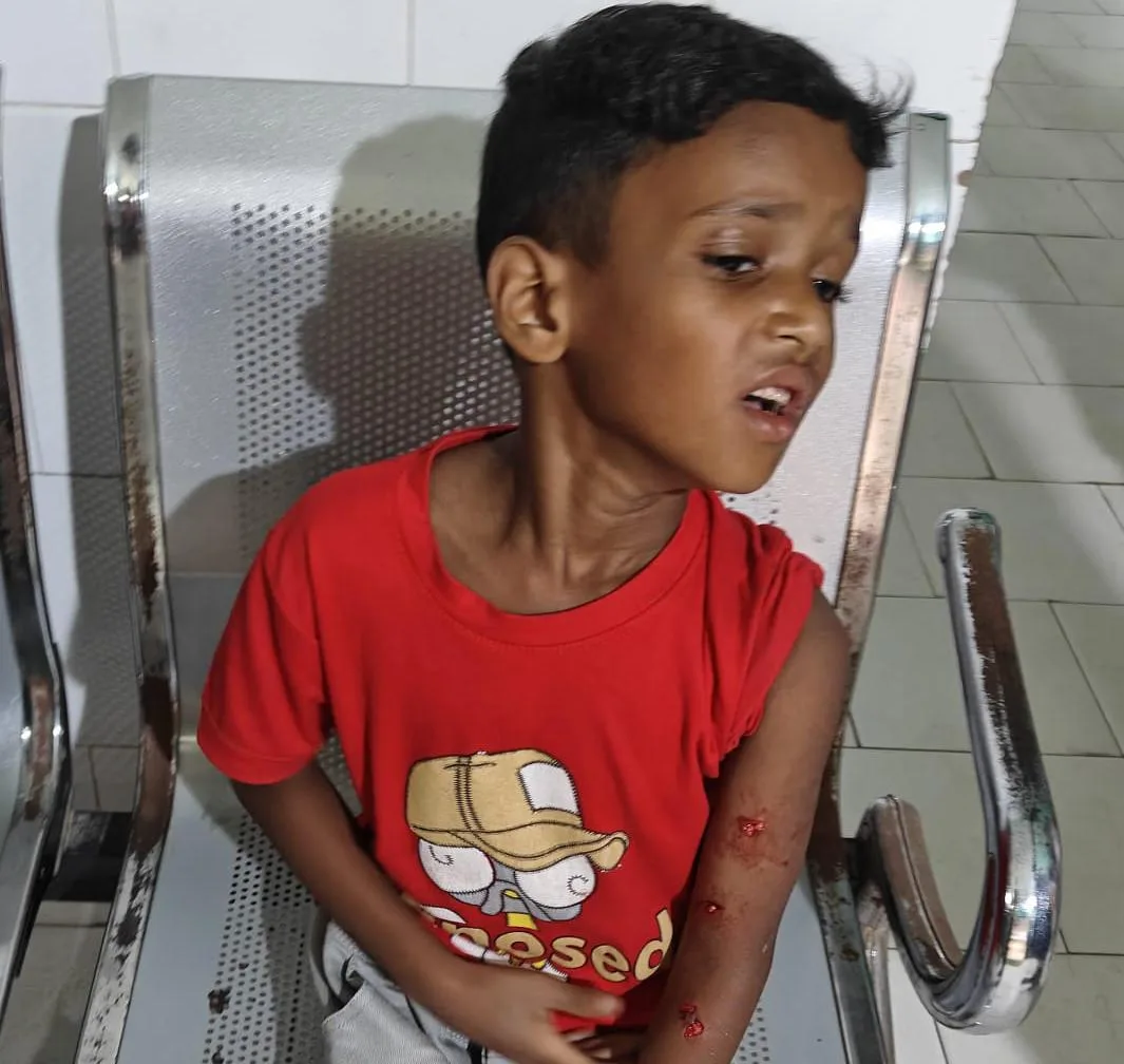खेलते समय मासूम पर कुत्ते का हमला, हाथ में कई जगह गहरे जख्म, अस्पताल में कराया गया इलाज