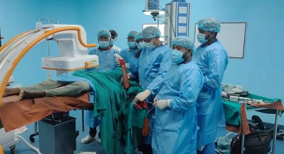 भागलपुर मॉडल सदर अस्पताल में पहली बार बिना चीरा लगाए टूटी हड्डी का सफल ऑपरेशन, सरकारी स्वास्थ्य सेवाओं में जुड़ी नई उपलब्धि